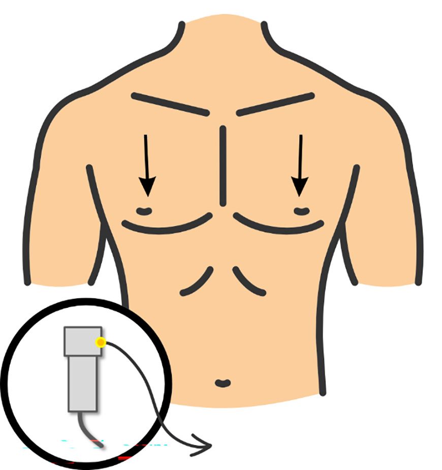 Figura 7: janelas ecocardiográficas de POCUS