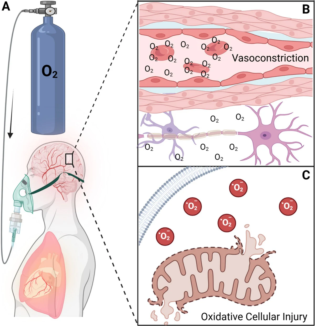 Fisiopatologia da hiperoxemia e seus efeitos no cérebro (Fig. 1 — Sekhon et al., Intensive Care Med 2026)
