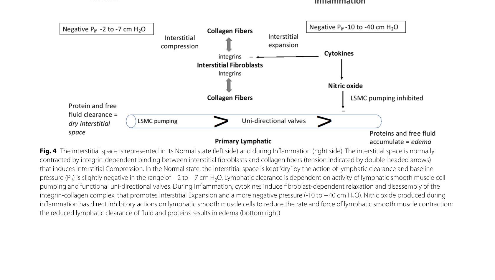 Figura 4 — Estado normal vs inflamação do espaço intersticial